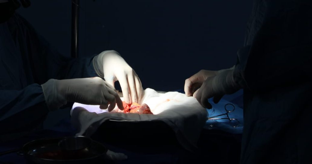 IMSS Bienestar de Mexicali logra exitoso trasplante renal de madre a hija