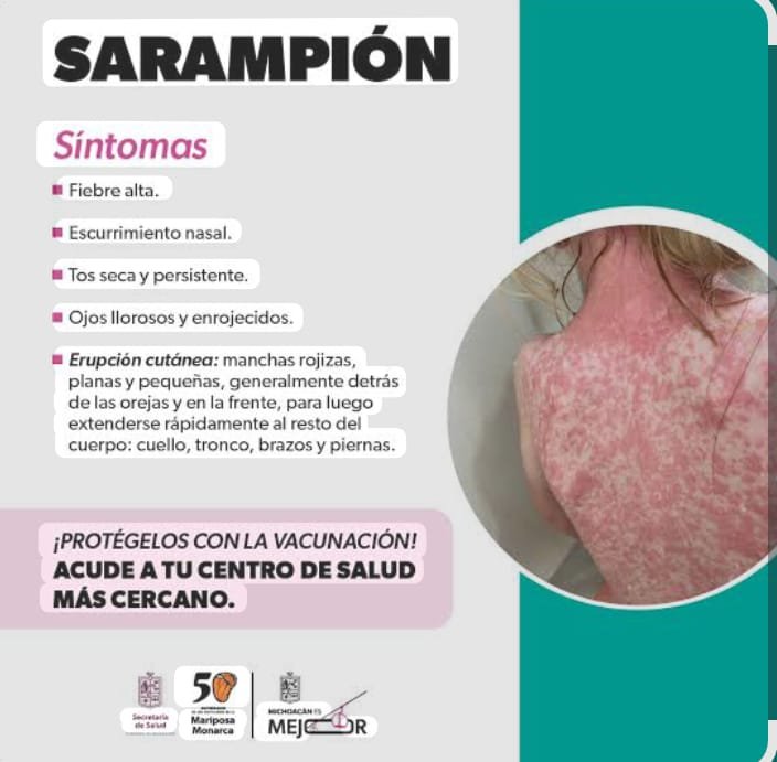 SARAMPION
